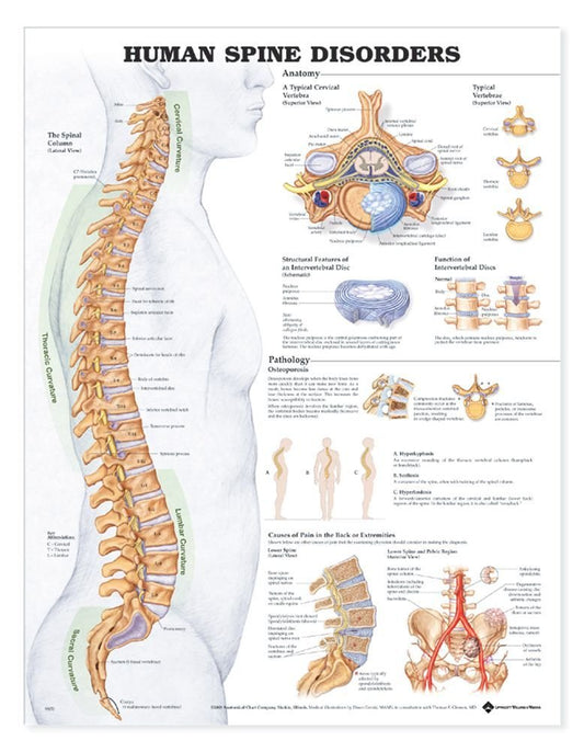 Human Spine Disorders