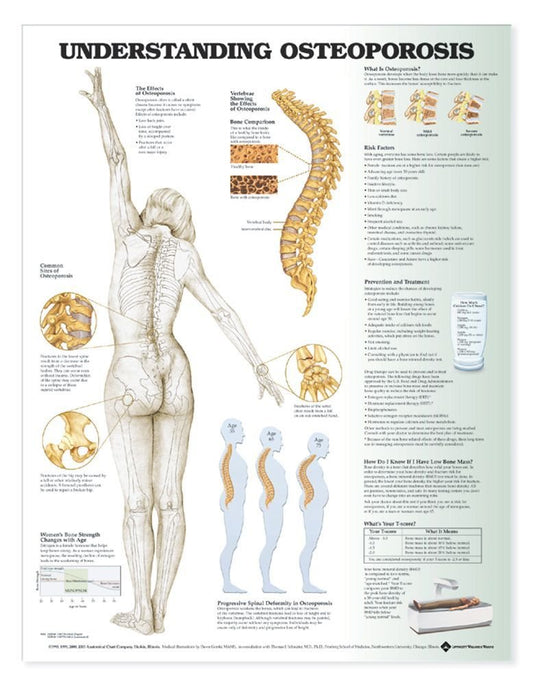 Understanding Osteoporosis
