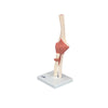 Functional Elbow Joint, Deluxe - Includes 3B Smart Anatomy