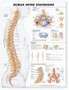 Human Spine Disorders